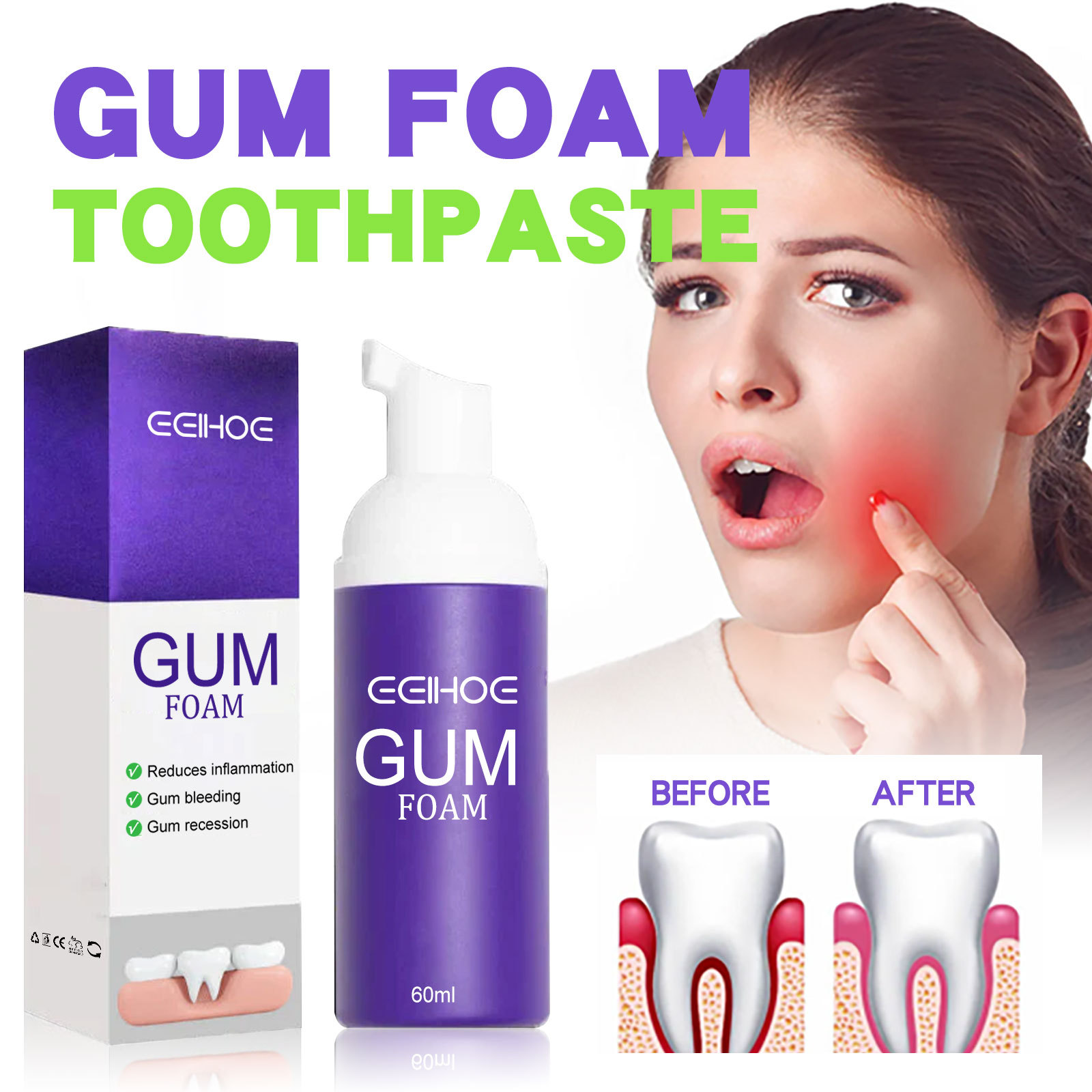 Teeth Whitening Yellow Teeth - Mousse de blanchiment des dents V34,