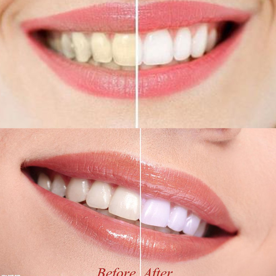 Poudre de charbon de bambou po - Teeth Whitening Yellow Teeth avis et prix