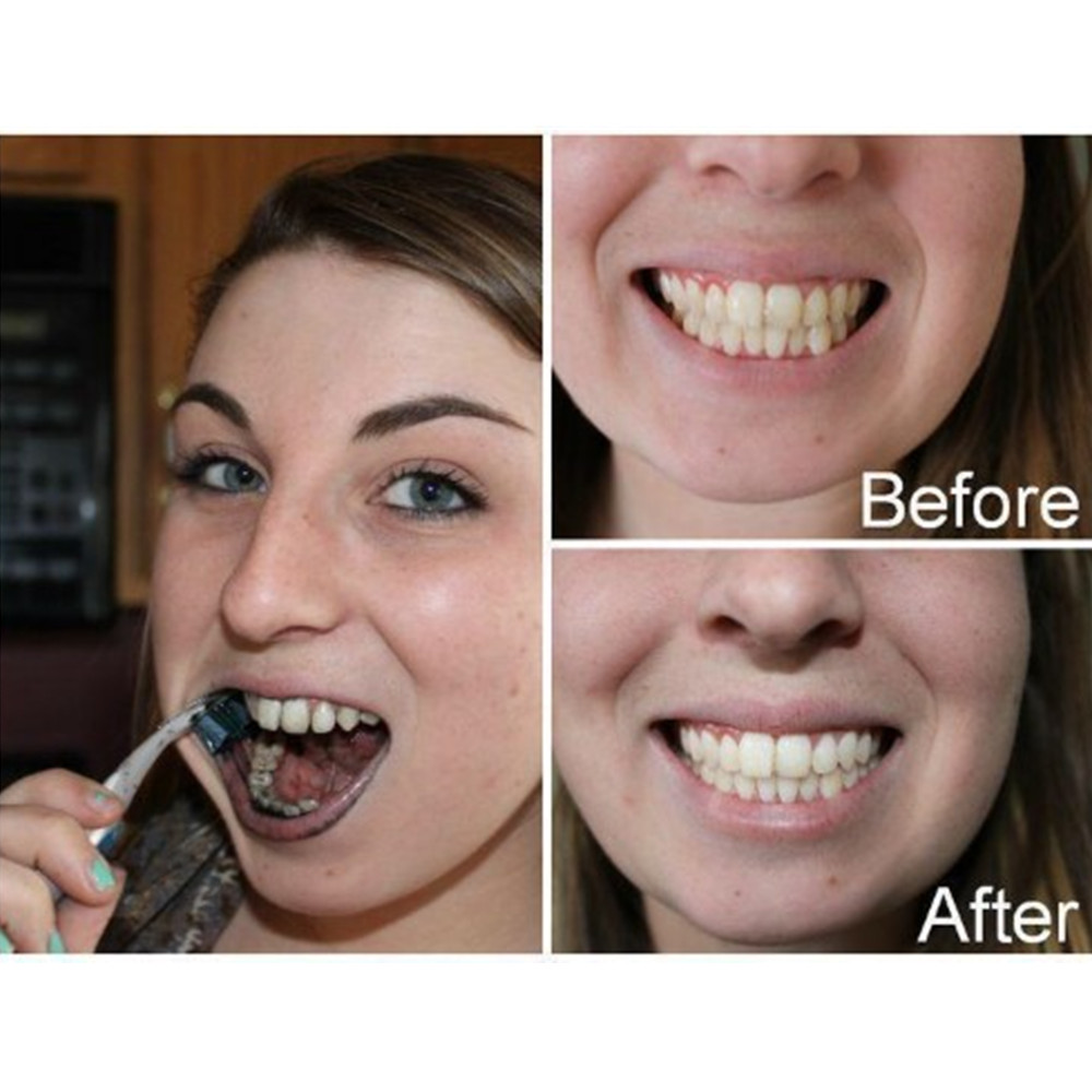 Poudre de charbon de bambou po - Teeth Whitening Yellow Teeth avis et prix