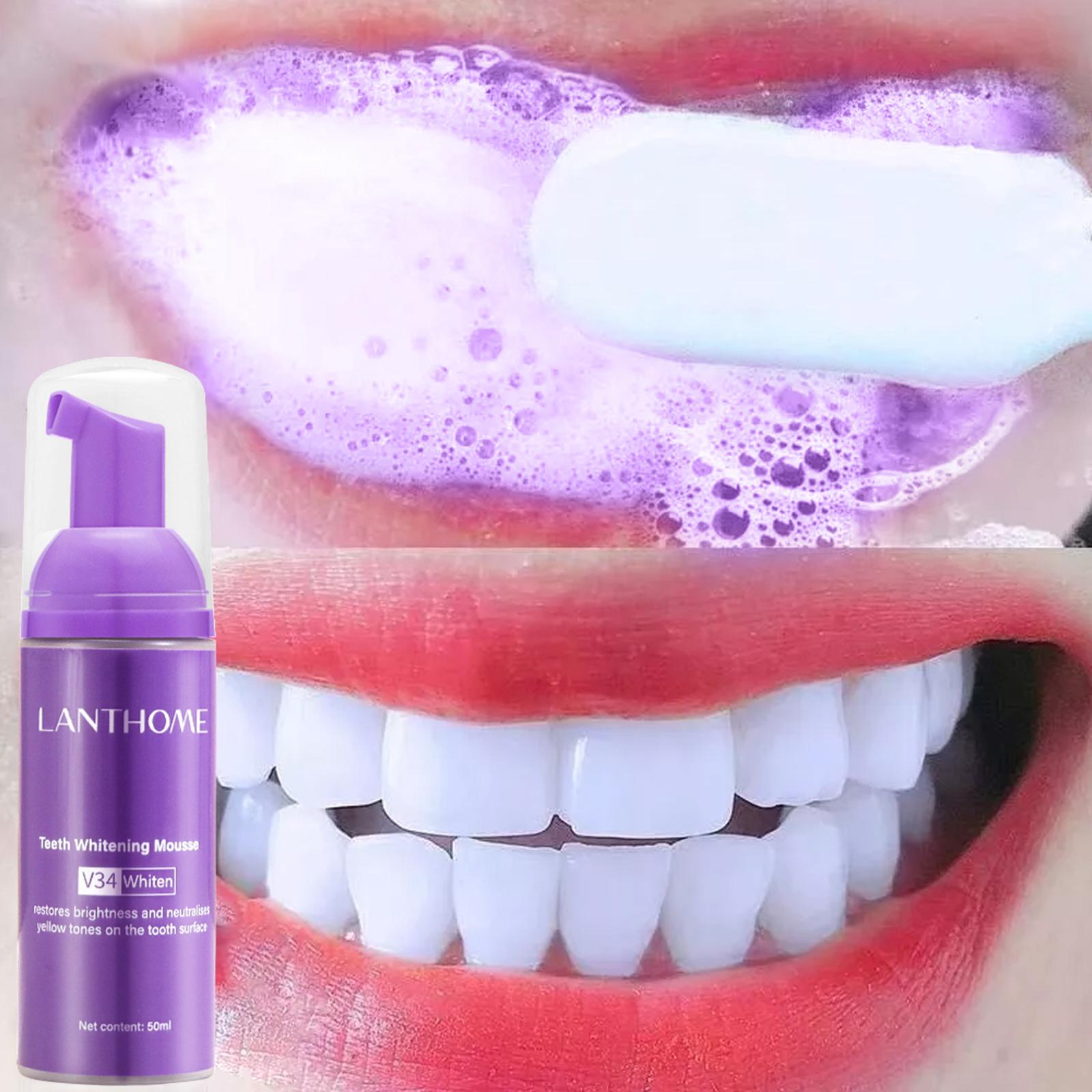 V34 Mousse nettoyage des dents - Teeth Whitening Yellow Teeth avis et prix
