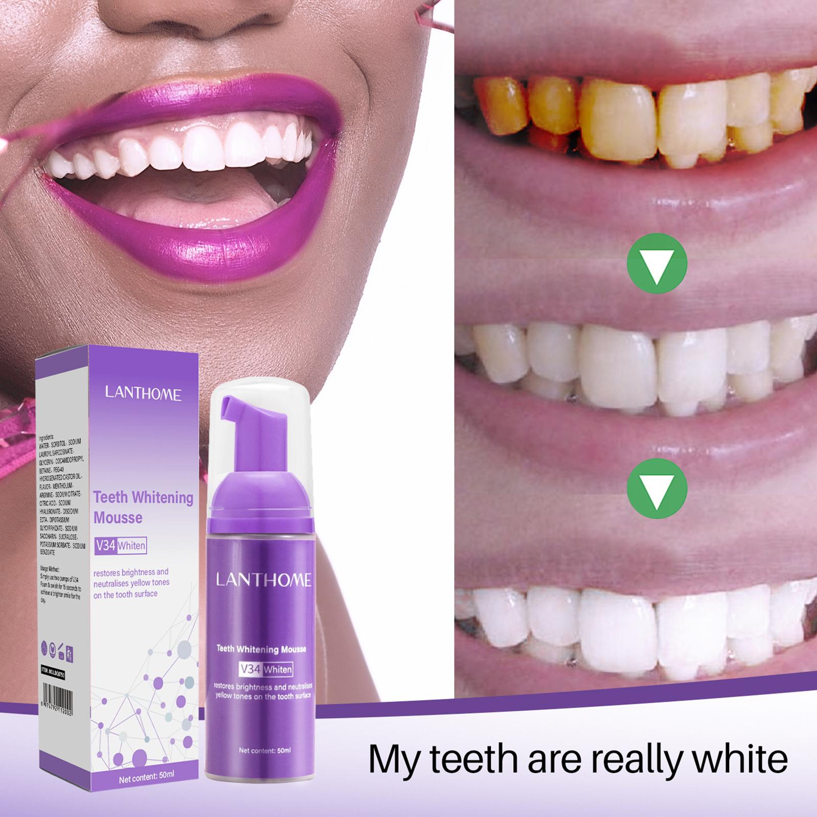 V34 Mousse nettoyage des dents - Teeth Whitening Yellow Teeth avis et prix