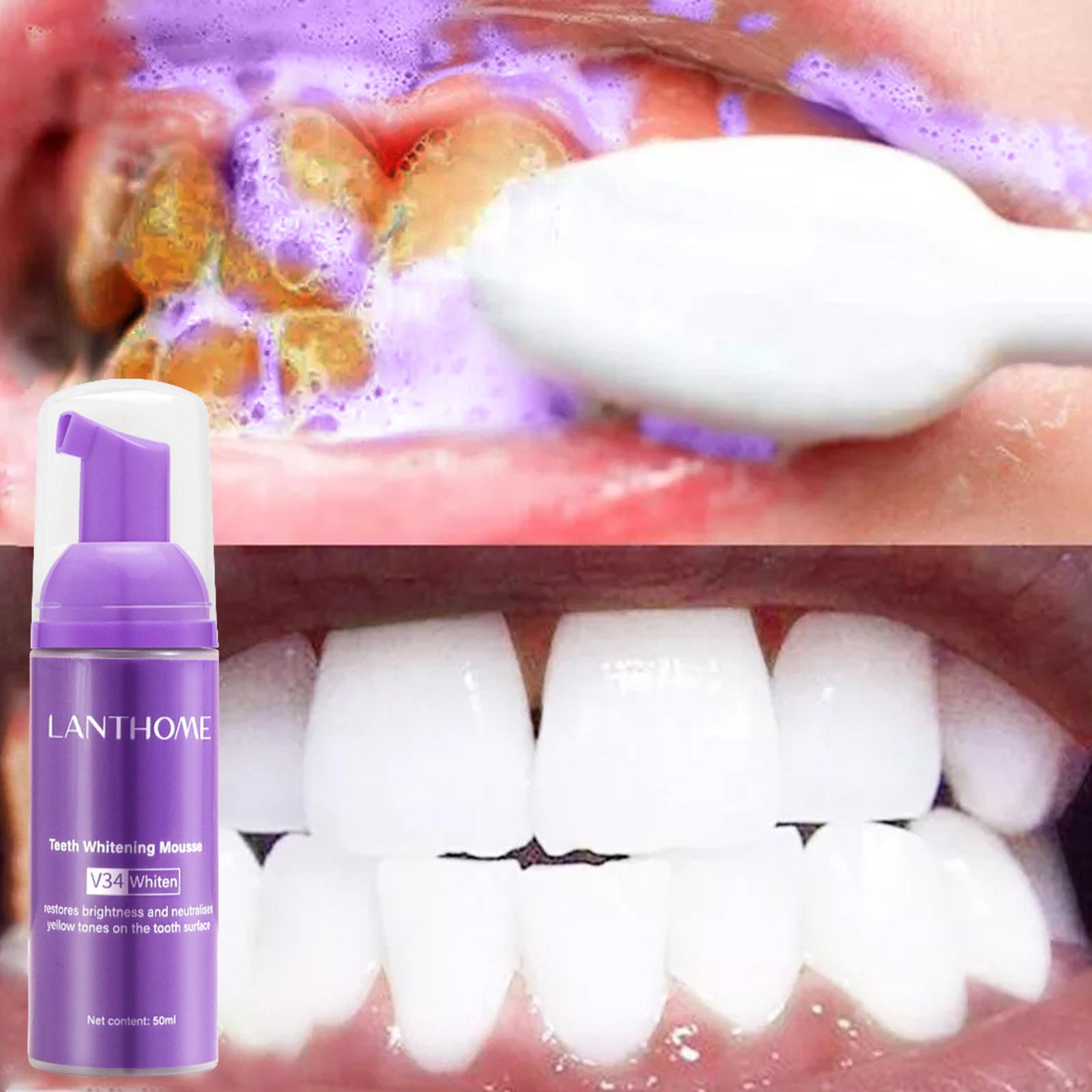 V34 Mousse nettoyage des dents - Teeth Whitening Yellow Teeth avis et prix