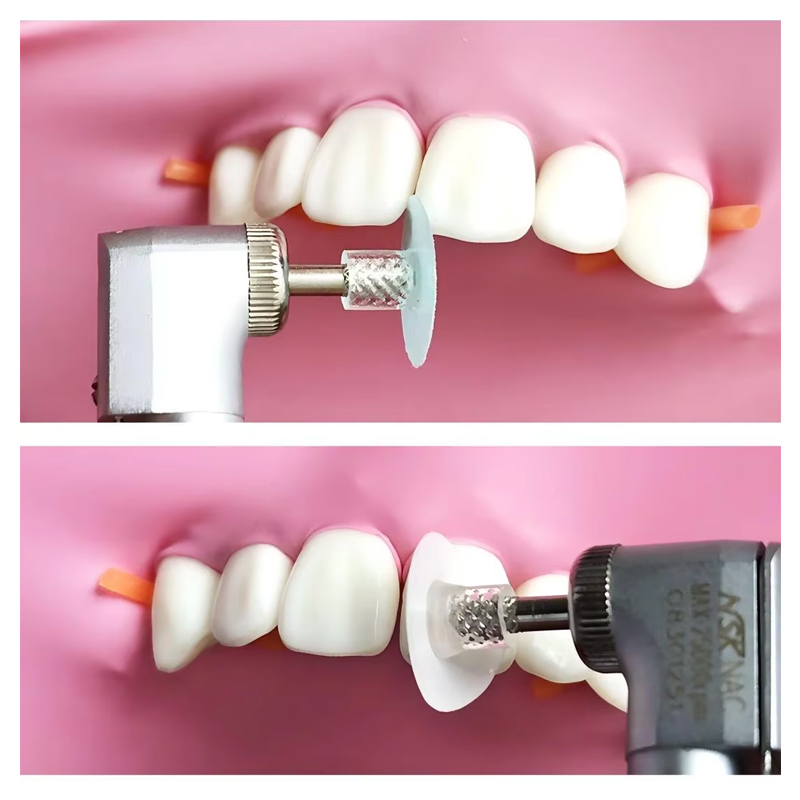 40 disques de polissage dentai - Teeth Whitening Express avis et prix