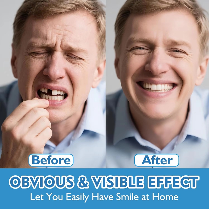 Prothèses dentaires complètes  - Teeth Whitening Instant avis et prix