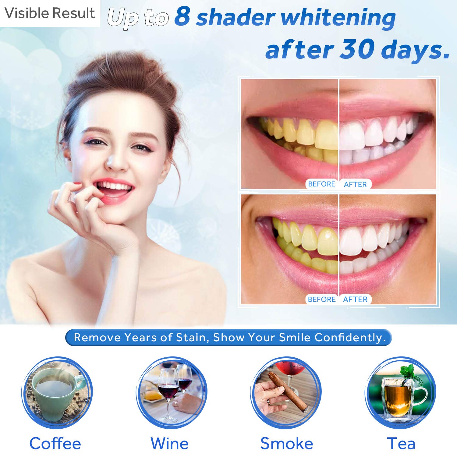 Gel de blanchiment des dents r - Teeth Whitening Price avis et prix