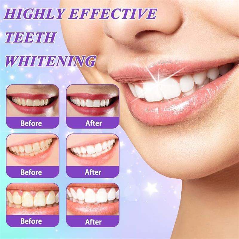 Mousse dentifrice blanchissant - Teeth Whitening Yellow Teeth avis et prix