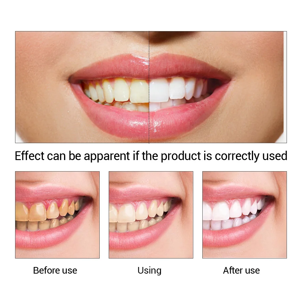 FTEENPLY poudre d'essence de b - Teeth Whitening Price avis et prix