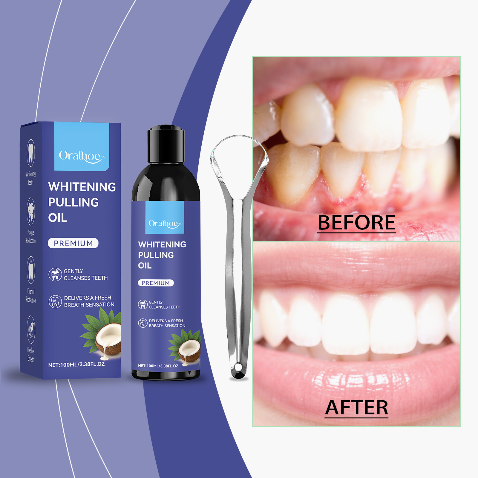 Bain de bouche à l'huile de co - Teeth Whitening With Coconut Oil avis et prix