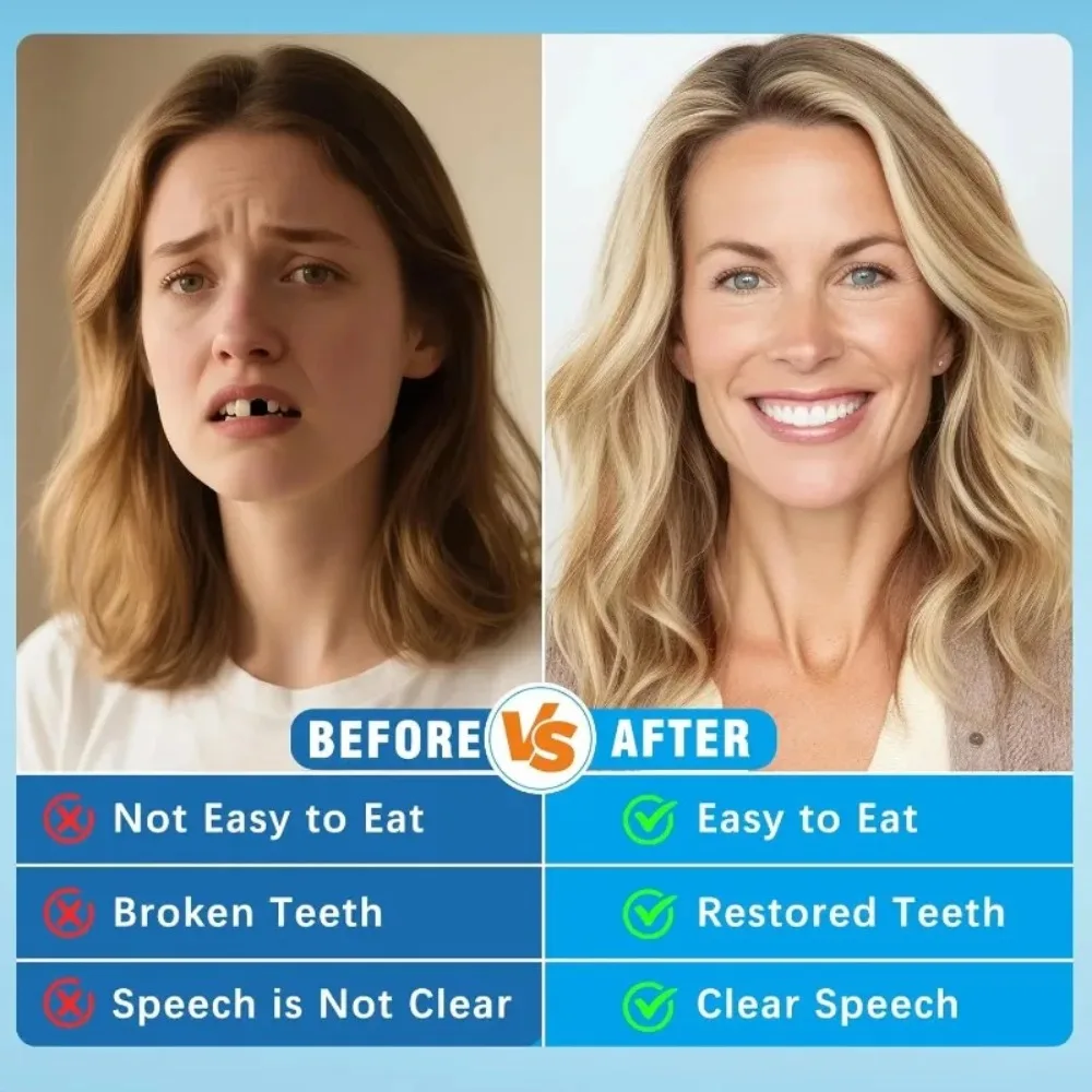Prothèses dentaires complètes, - Teeth Whitening Instant avis et prix