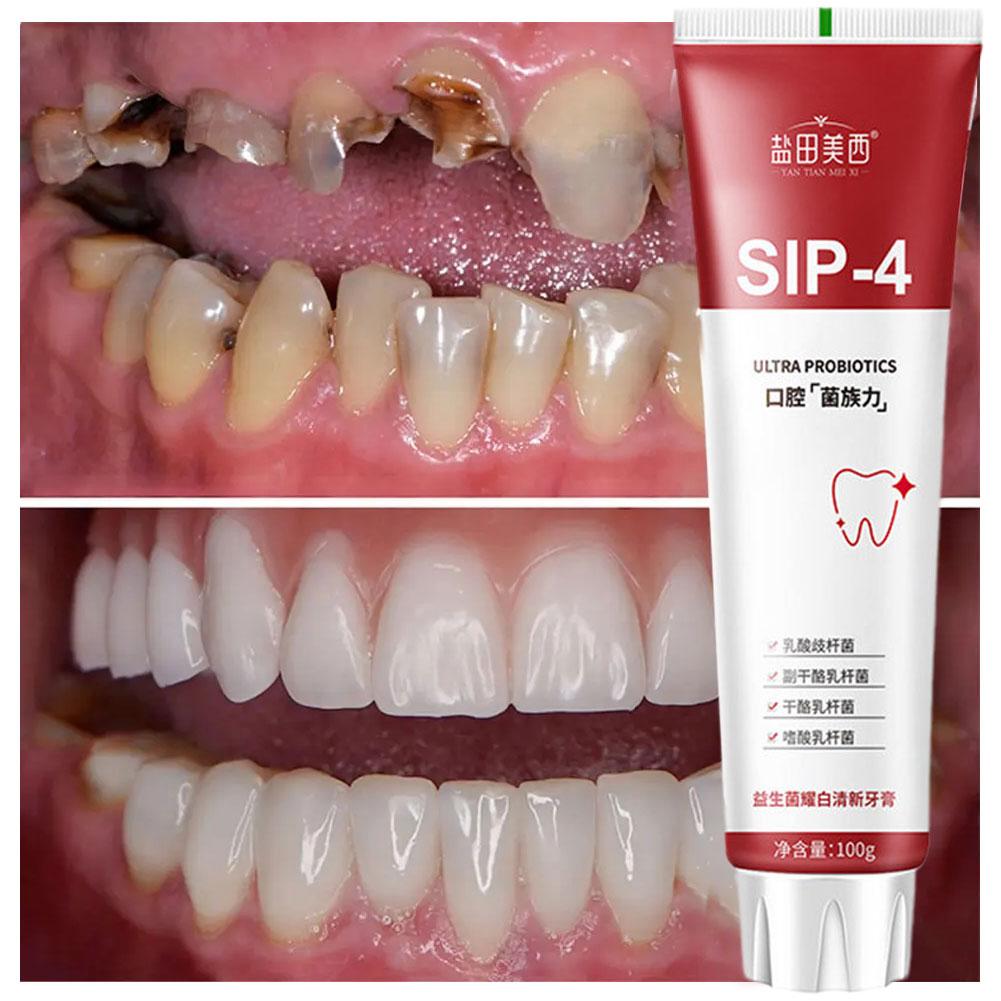 Dentifrice blanchissant probio - Teeth Whitening Yellow Teeth avis et prix